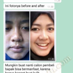 madu untuk kulit kusam sensitif